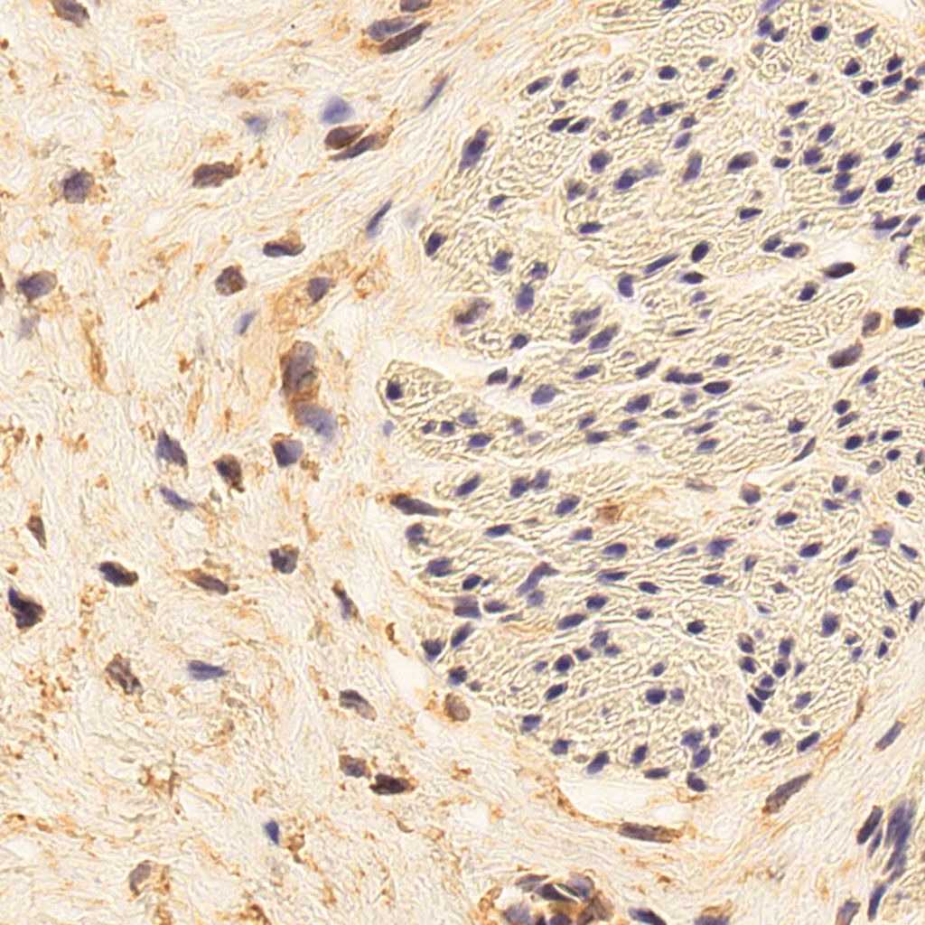 sars-cov-2 gene expression in a human fetus